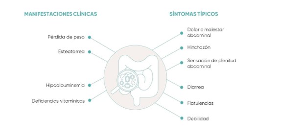 manifestaciones clínicas del sibo